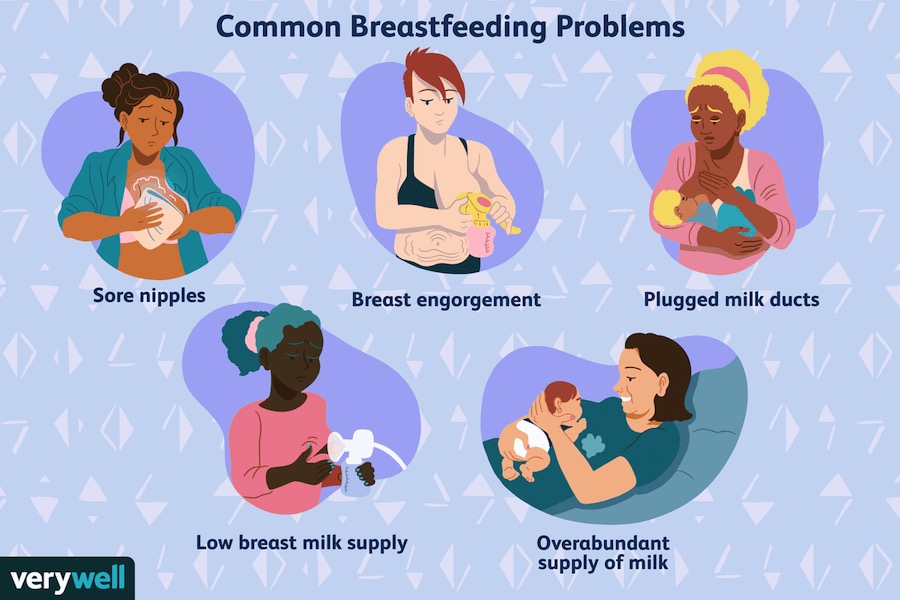 Common Breastfeeding Illnesses