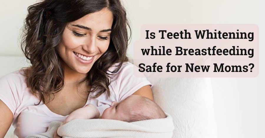 teeth whitening while breastfeeding