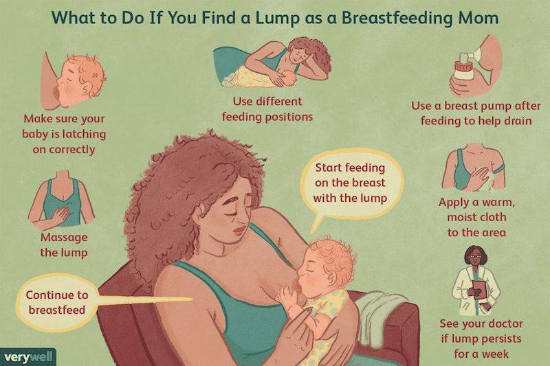 lump in breast after stopping breastfeeding