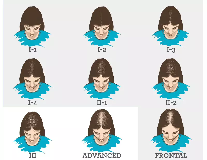 Skin and Hair Changes after Stopping Breastfeeding